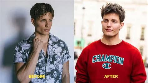 matt rife skinny|Matt Rife denies plastic surgery, explains why face changed